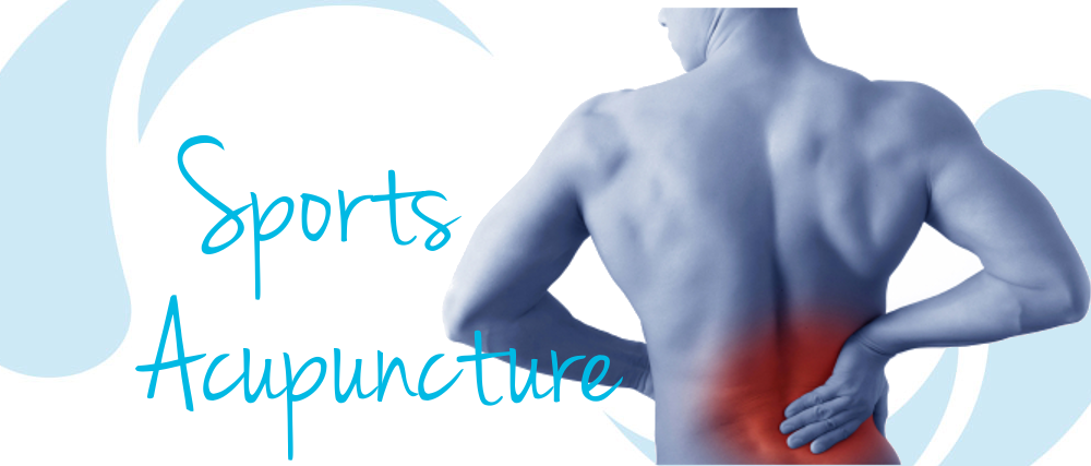 Sports Acupuncture Sports Acupuncture
